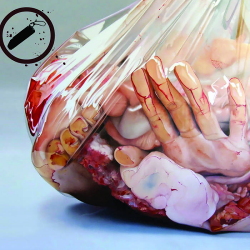 Atropine - Human Emulsion (2CD) (2020)